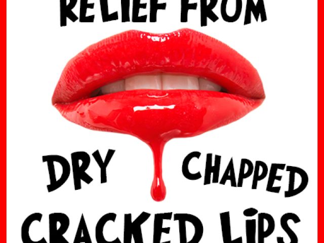 Relief from Dry, Chapped, & Cracked Lips (featured image)