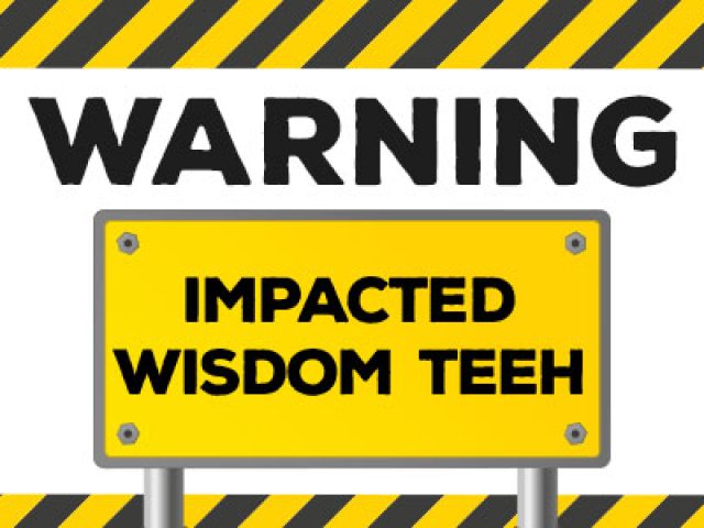 Warning Signs of Impacted Wisdom Teeth (featured image)