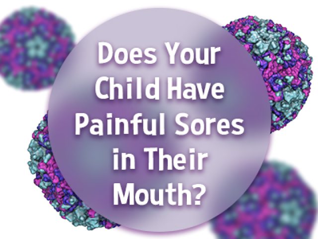 Does Your Child Have Painful Sores in Their Mouth? This Virus Could be the Cause (featured image)