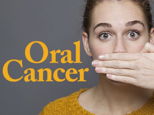 Oral Cancer – Protection & Early Detection (featured image)