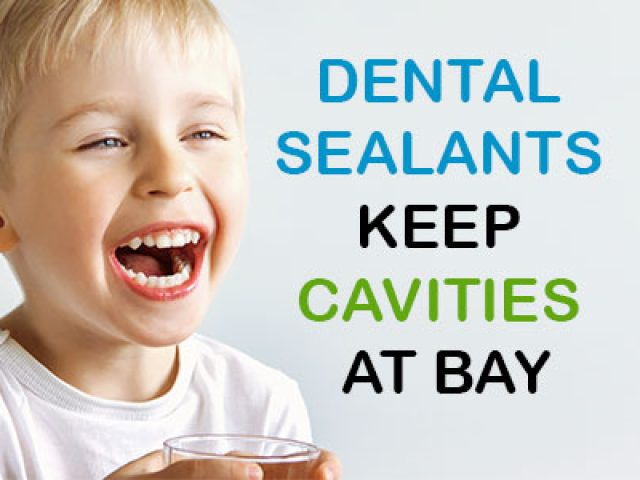 Dental Sealants Keep Cavities at Bay (featured image)